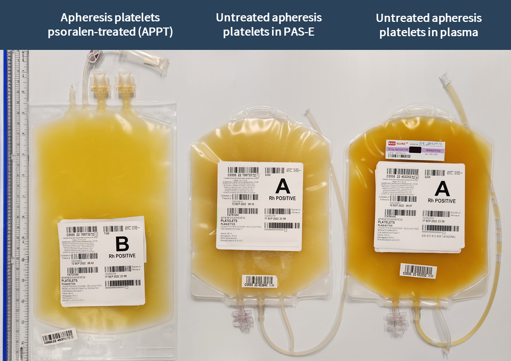 Three types of platelet units side-by-side.