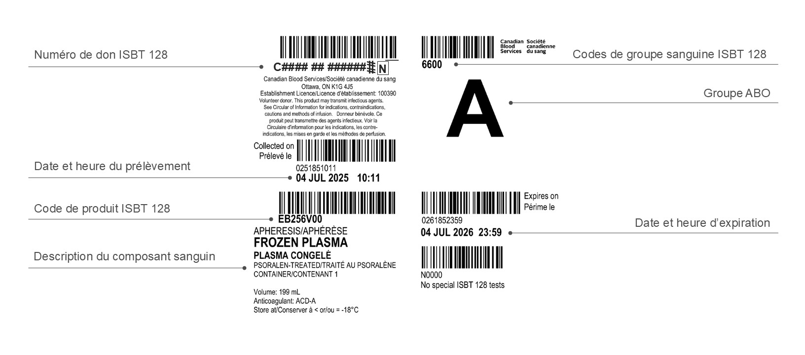 Exemple d’une étiquette de plasma-aphérèse traité au psoralène.