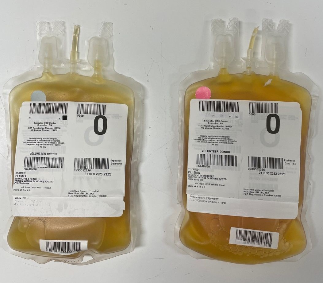 Another example of typical variation of plasma produced from whole blood. 