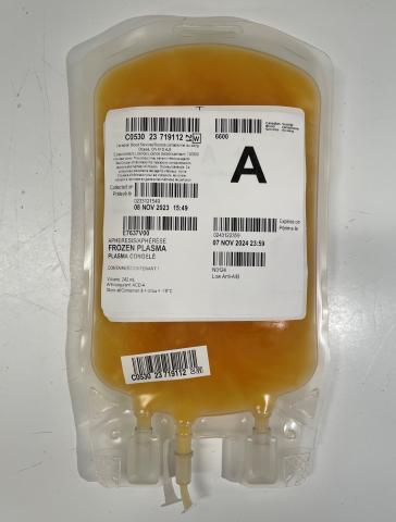 A unit of plasma photographed prior to thawing (viewed from the front)..