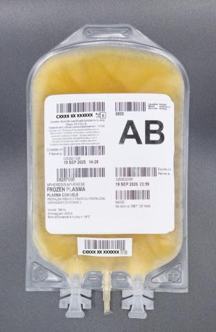 An example of a typical unit of apheresis frozen plasma, psoralen-treated from Canadian Blood Services. This image shows the back of the frozen unit 