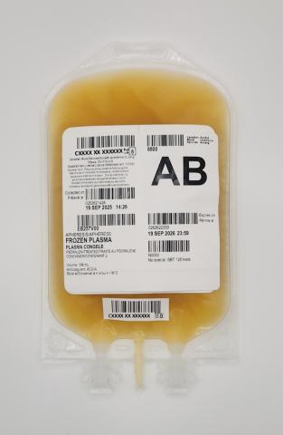 An example of a typical unit of apheresis frozen plasma, psoralen-treated from Canadian Blood Services. 