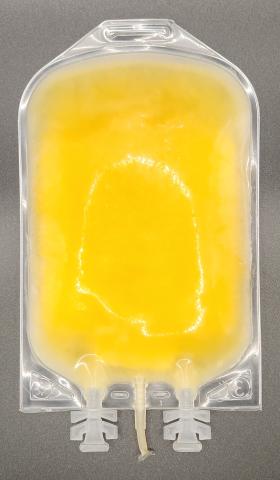 An example of a typical unit of apheresis frozen plasma, psoralen-treated from Canadian Blood Services. This image shows the back of the frozen unit 