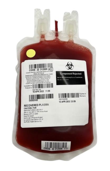 Plasma: Red blood cell contamination | Professional Education