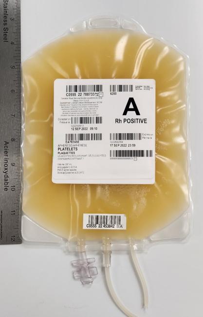 A unit of apheresis platelets in PAS laying on a flat surface next to a ruler.
