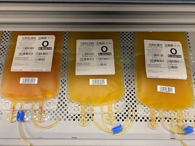 Three pooled platelet units in varying shades of yellow lay side-by-side on a shaker.