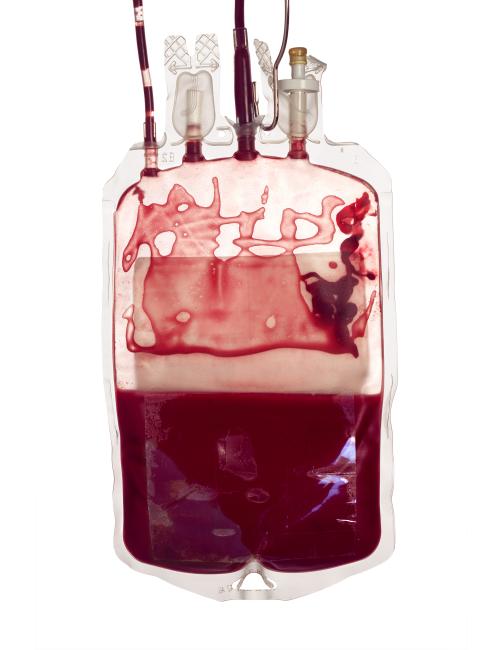 Red blood cells: Bacterial contamination | Professional Education