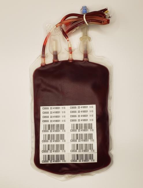 A unit of red blood cells labelled with barcodes and numbers.