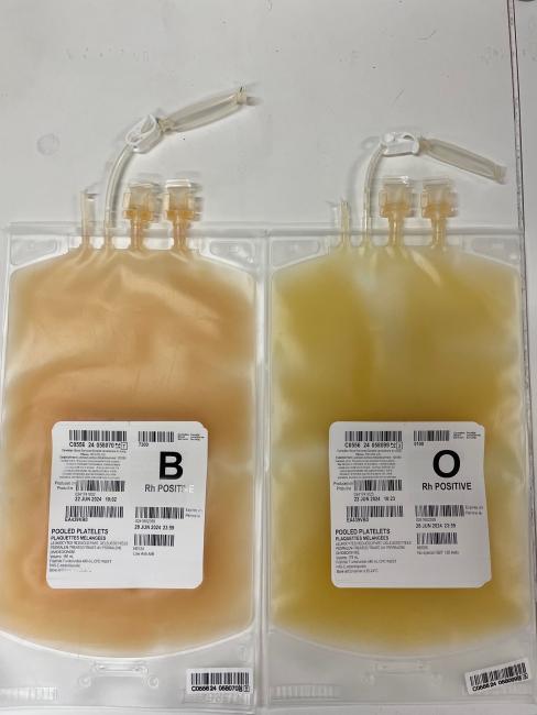 Platelets: Red blood cell contamination | Professional Education