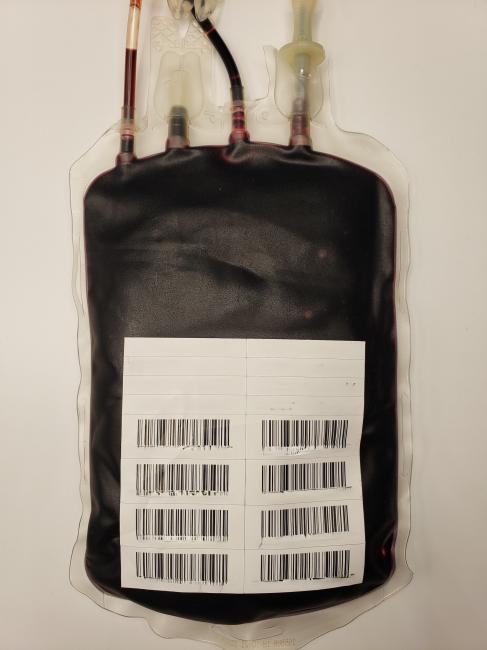 Serratia liquefaciens contamination, Day 25 