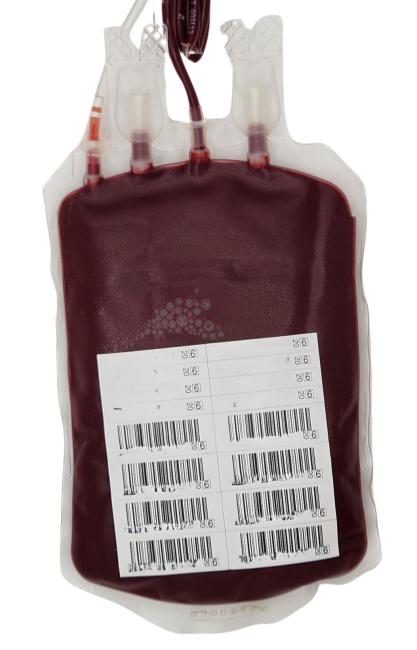 An example of a typical RBC unit viewed from the back. 