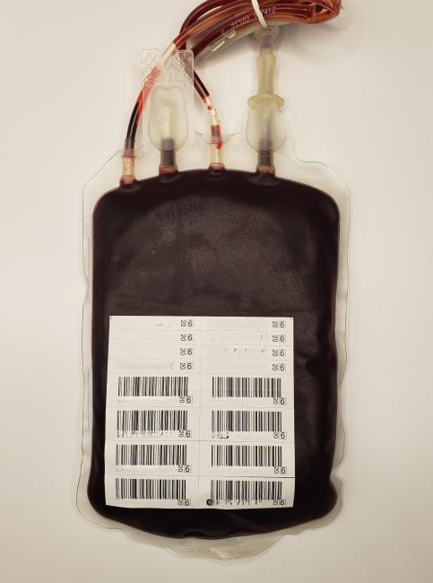 Serratia marcescens contamination, Day 17